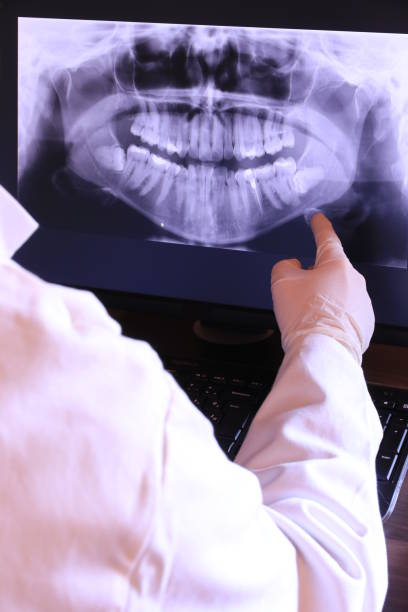 Best Emergency Dental Extractions in Troy, AL